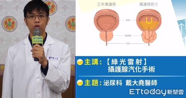 ▲成大醫院斗六分院泌尿科戴大堯醫師指出，攝護腺肥大是老人化社會的共同問題，攝護腺「綠光雷射汽化手術」，可讓排尿變得順暢，也不用再吃藥了。（圖／記者林悅翻攝）