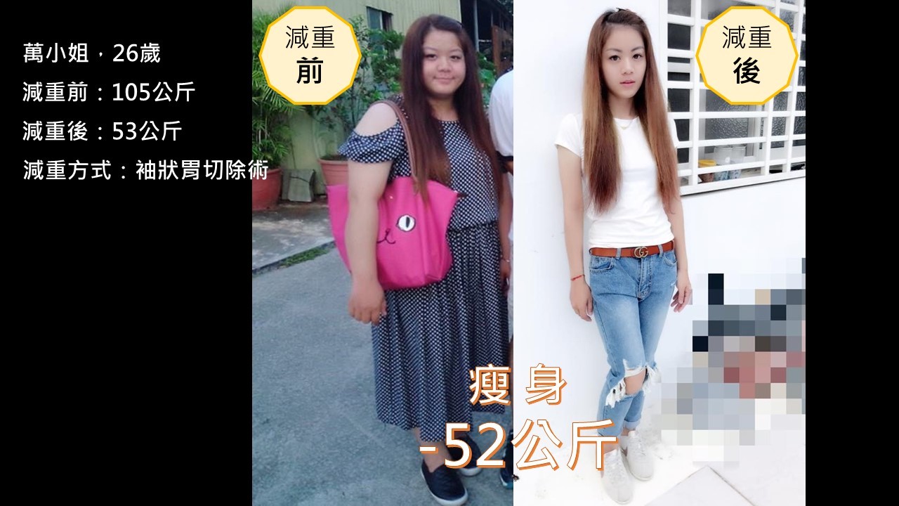 ▲萬小姐術後3年體重持續維持減重52公斤後的體重53公斤沒有復胖，月經也變得規律。（圖／奇美醫學中心提供）