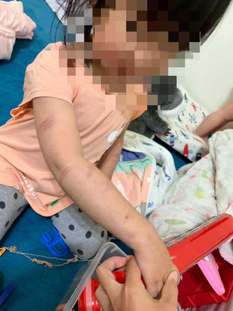 ▲台南再傳虐童案，3歲小女童疑遭繼父痛打全身瘀青，台南市社會局與警局已介入查處。（圖／翻攝自臉書爆料公社，下同）