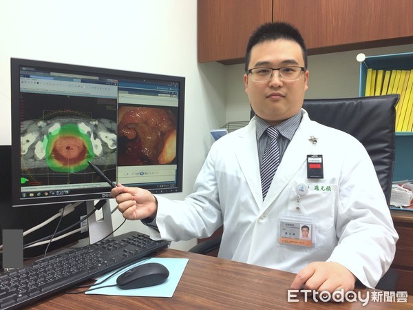 ▲▼直腸癌。（圖／澄清醫院提供）