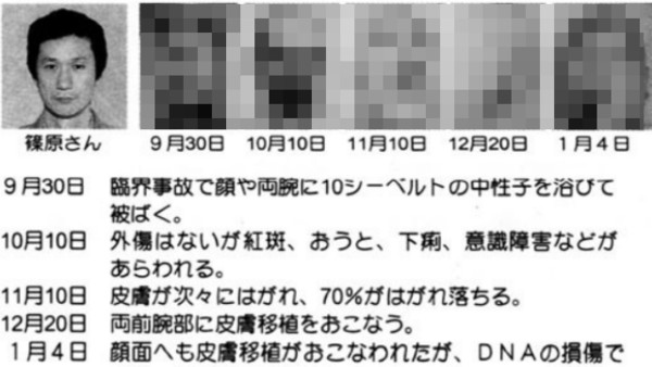 日本東海村核事故 工人作業程序出錯身體急速潰爛強撐天 法式軟糖 鍵盤大檸檬 Ettoday新聞雲
