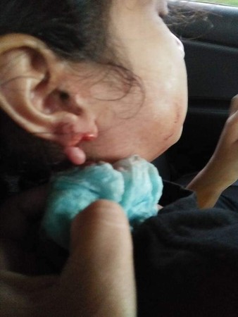 ▲▼馬來西亞女童玩耍時，耳環不慎勾到窗簾，直接從耳朵上被扯下，場面驚悚。（圖／翻攝自FB／Apih Poksua）