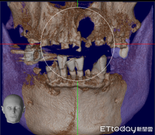 ▲▼。（圖／口腔外科醫師林葳提供）