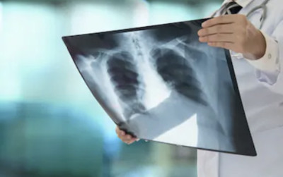 OL「照胸部X光」被要求脫光光！醫院證實：處罰醫生離崗7天