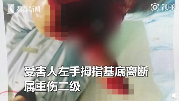 ▲嫉妒和情夫走一起！小三當眾揮刀「砍斷正宮手指」...哭訴：被背叛（圖／翻攝自看看新聞）