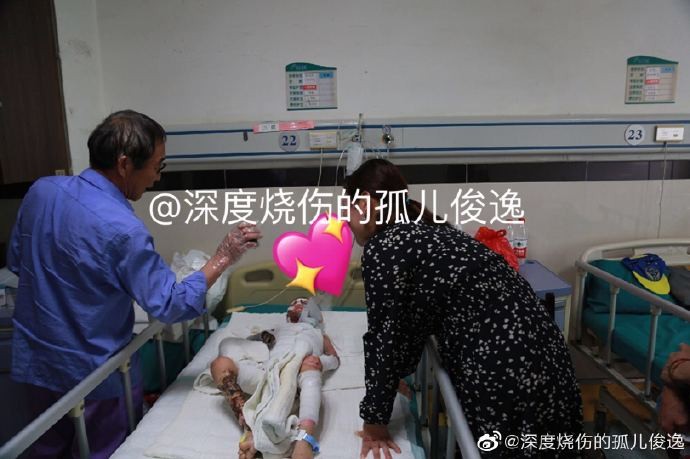 ▲▼4歲男「雙手截肢」後遭生母拋棄。（圖／翻攝自微博）