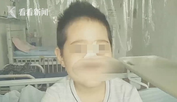 ▲山東6歲白血病男孩化療失去半張臉。（圖／翻攝自《看看新聞Knews》）