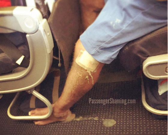 ▲▼客機上有乘客腿傷膿流一地。（圖／翻攝自IG@passengershaming）