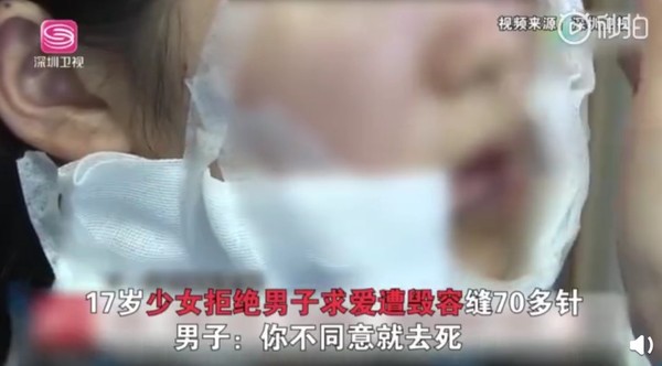 打工被恐怖癡漢纏上　17歲少女遭割臉毀容「縫70多針」。（圖／翻攝自大陸《鳳凰網視頻》）