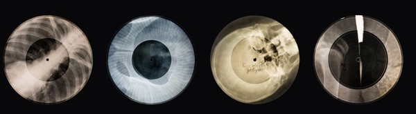 ▲▼BONE MUSIC，用人體X光片作成的黑膠唱片。（圖／翻攝自BONE MUSIC展官網。
