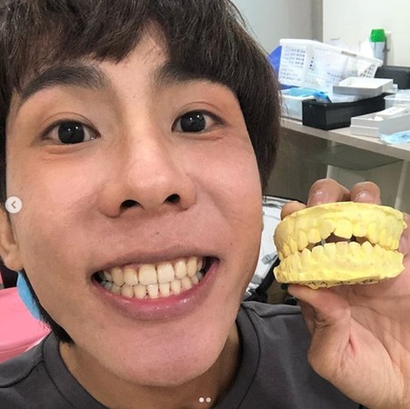 ▲林進15日開心宣布拆下牙套。（圖／翻攝自林進Instagram） 