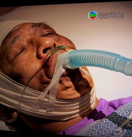 ▲▼八點檔荒謬醫療畫面。（圖／ICU醫師陳志金提供）