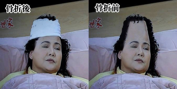 ▲▼八點檔荒謬醫療畫面。（圖／ICU醫師陳志金提供）