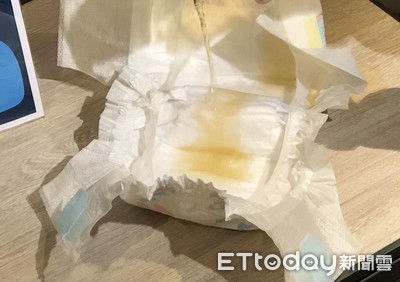 陰道漏尿!女飄騷味遭判終身包尿布 醫出招治癒登國際醫學會