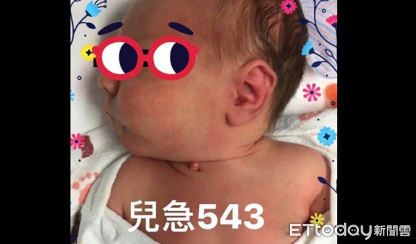 ▲吳昌騰脖子小肉瘤。（圖／記者嚴云岑攝）