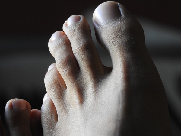▲▼腳趾,指甲,腳掌,趾頭,腳,香港腳,腳臭。（圖／翻攝自pixabay）