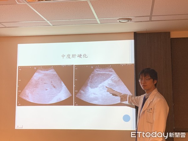 ▲肝硬化腹水陰囊像葡萄柚。（圖／記者嚴云岑攝）