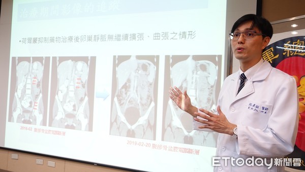 性早熟妹6歲長胸部！　初經沒來卻確診全球首例「多產病」（圖／記者嚴云岑攝）