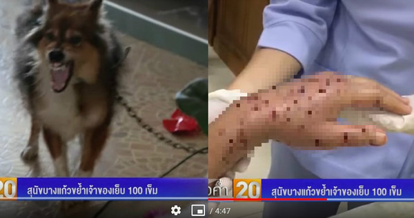 7歲愛犬突然發狠攻擊　老奶奶遭噬咬「滿手是洞」慘縫100針。（圖／翻攝自YouTube／BRIGHT TV）
