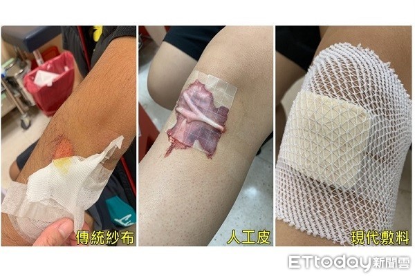 ▲▼。（圖／亞大醫院提供）