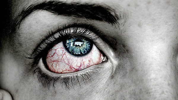 ▲▼眼睛，發炎，紅腫，血輪眼。（圖／取自免費圖庫pixabay）