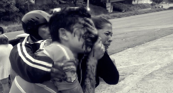 ▲▼委內瑞拉正值燃料短缺問題，16歲少年查孔（Rufo Chacon）在抗議過程中被警察擊中，雙眼失明。（圖／翻攝自推特／Galac）