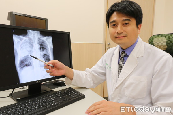 ▲▼亞大醫院胸腔外科主治醫師呂庭聿指出肺炎位置。（圖／亞洲大學附屬醫院提供）