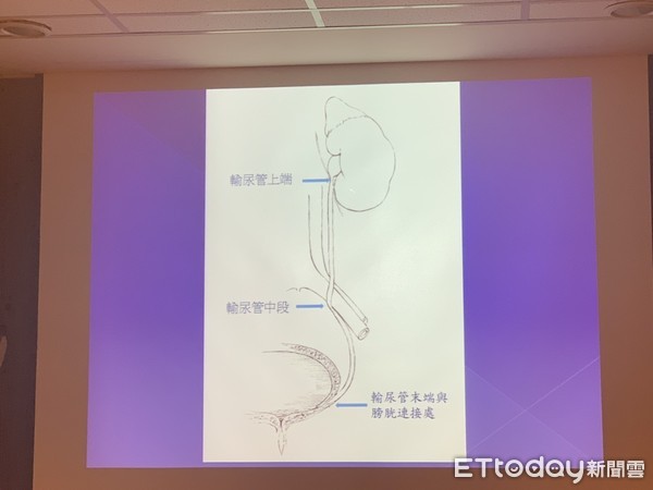 ▲腎結石,書田診所泌尿科主任醫師周固  。（圖／記者嚴云岑攝）