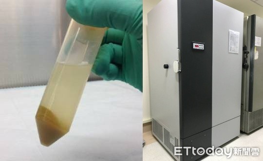 ▲長庚糞菌移植。（圖／長庚醫院提供）