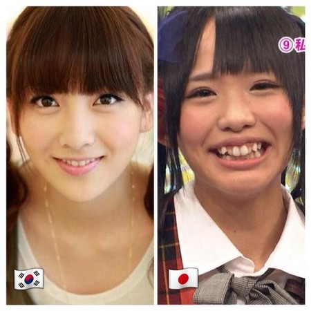 Мода в японии на кривые зубы