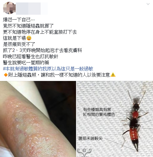 ▲▼正妹打隱翅蟲，超慘下場出爐。（圖／Facebook／爆怨公社）