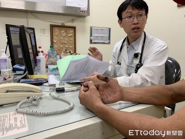 ▲▼截肢,抽菸,柏格氏症。（圖／門諾醫院提供） 