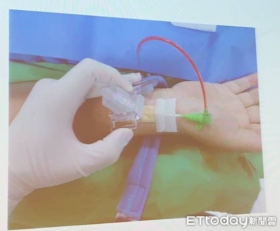 ▲甲殼素止血。（圖／記者嚴云岑攝）