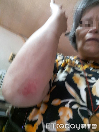 ▲▼階梯約有5至6公分的落差，導致謝婦跌倒後四肢多處挫傷，第12節胸椎壓迫性骨折。（圖／記者黃孟珍翻攝）