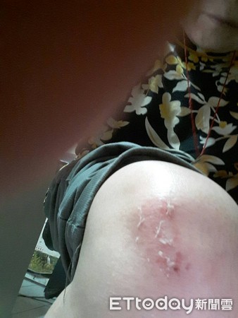 ▲▼階梯約有5至6公分的落差，導致謝婦跌倒後四肢多處挫傷，第12節胸椎壓迫性骨折。（圖／記者黃孟珍翻攝）