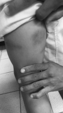 ▲▼朴子小四女童疑遭母親同居人虐打。（圖／記者翁伊森翻攝）