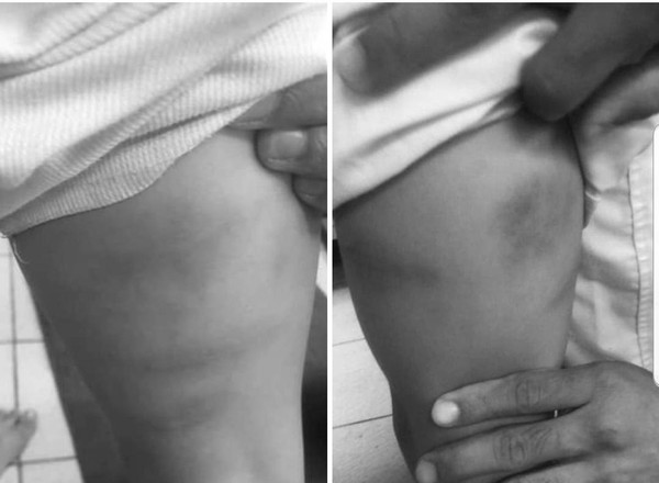 ▲▼朴子小四女童疑遭母親同居人虐打。（圖／記者翁伊森翻攝）