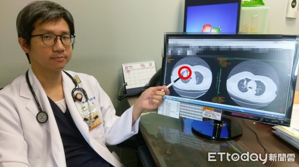 ▲▼早餐娘肺腺癌。（圖／長安醫院提供）
