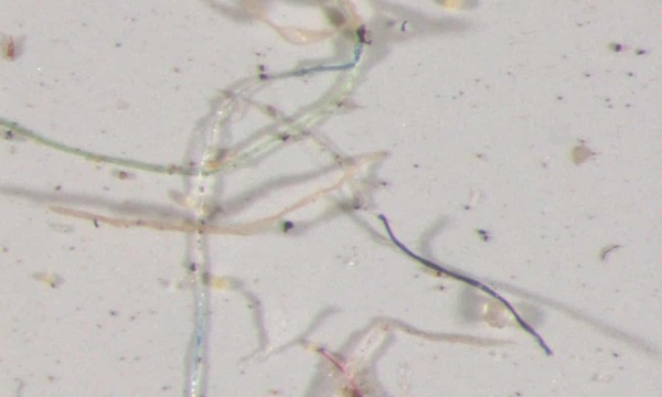 ▲科羅拉多州採集的雨水經顯微鏡可看到，雨水中含有不同顏色塑膠微粒。。（圖／取自美國地質調查局）