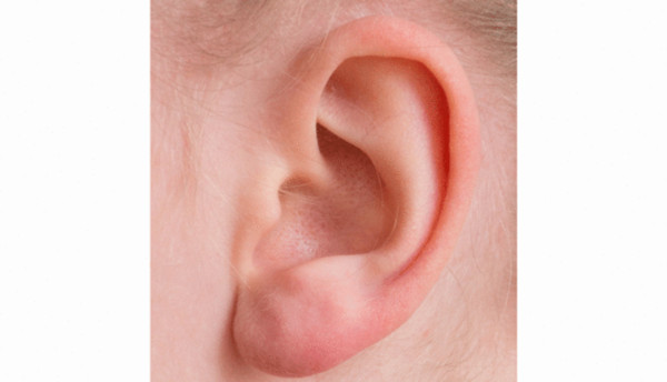 棉花棒恐傷耳膜、將污垢愈推愈裡面　專家教你清耳朵溫和4招