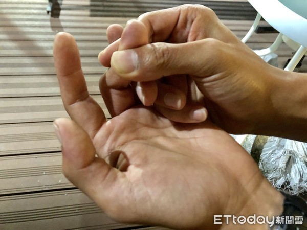 ▲板機指好發在中指和拇指，會有伸不直的狀況。（圖／記者趙于婷攝）