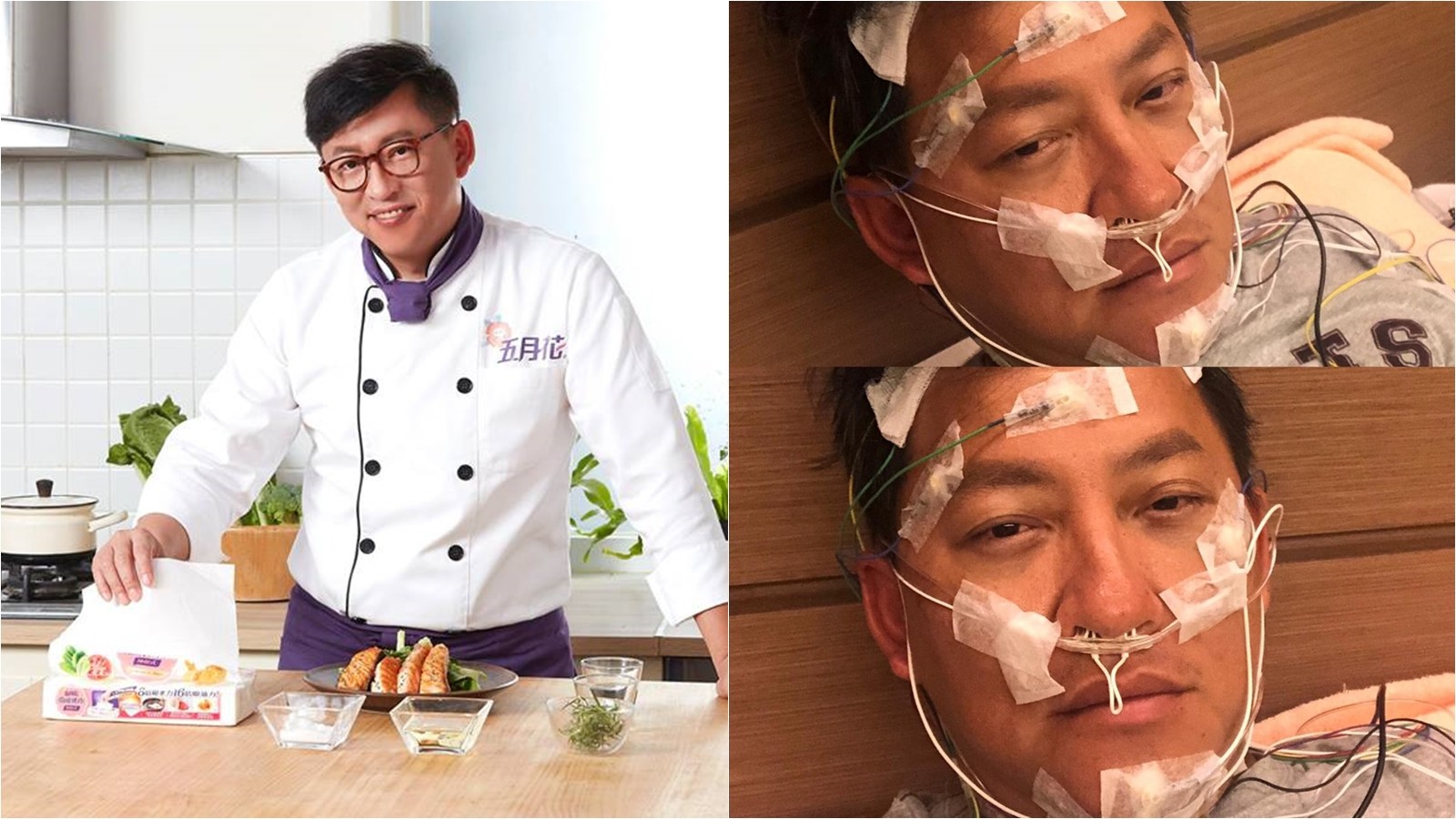 詹姆士呼吸中止症 恐失味覺 醫曝檢測 4種波型 解答 Ettoday健康雲 Ettoday新聞雲