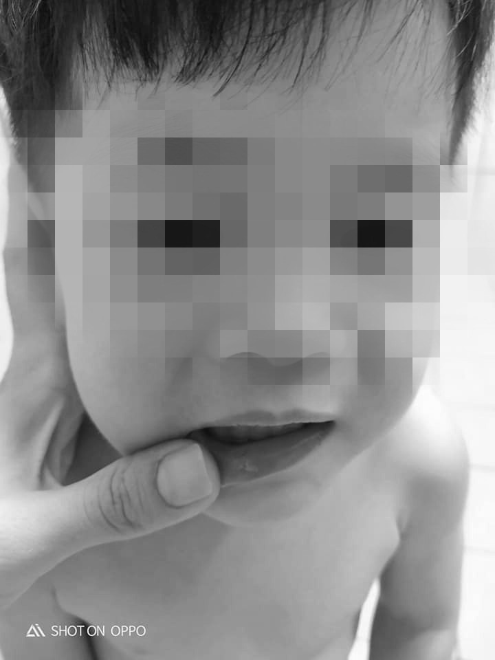 ▲▼新竹旅館牆面釘子外露，2歲童撞傷嘴。（圖／翻攝自爆料公社）