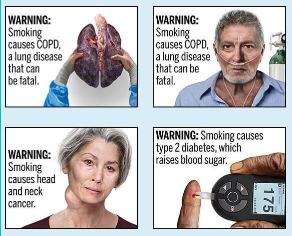 ▲▼吸菸警告圖。（圖／翻攝自FDA）
