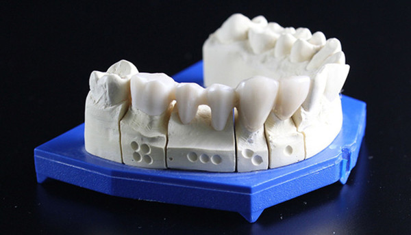 預防牙周病就靠2法寶　中醫師公開護齒秘訣