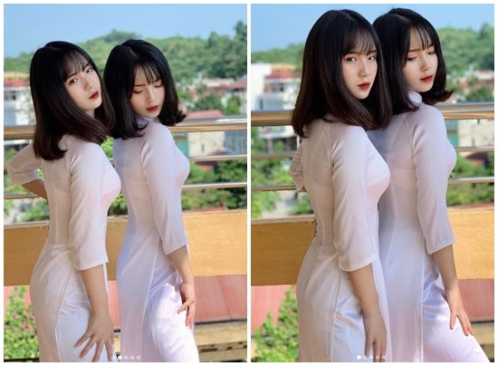 ▲越南超美雙胞胎。（圖／翻攝自IG）