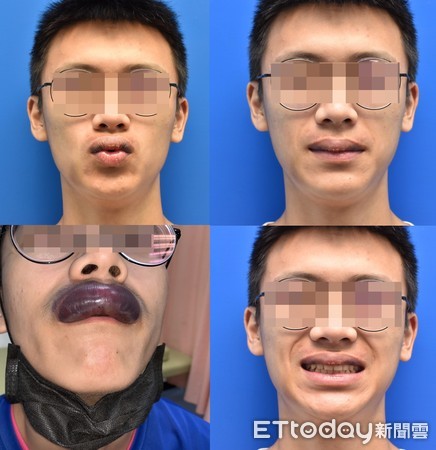 ▲▼。（圖／賴昕隄醫師提供）