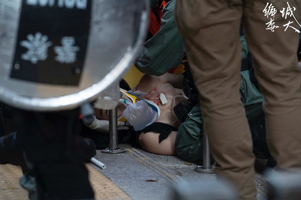 ▲香港有示威者被實彈擊中左胸受傷。（圖／翻攝香港城市大學學生會編輯委員會）