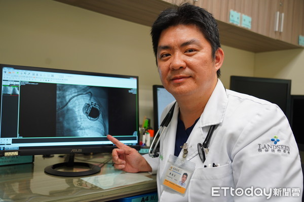 ▲▼。（圖／聯新國際醫院提供）