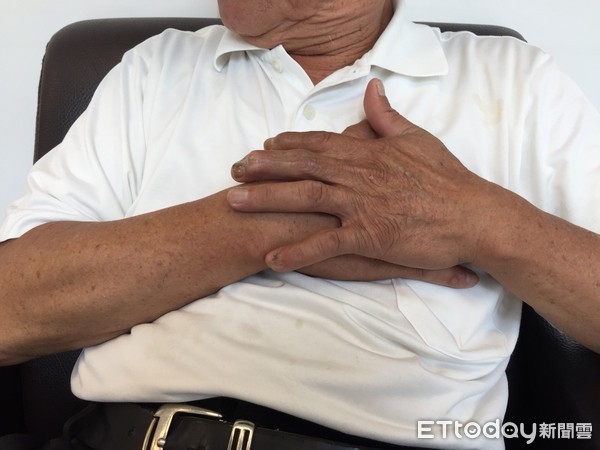 ▲▼圖說1-2：長安醫院心臟血管科陳士仁醫師表示，陳先生經檢查是下壁急性心肌梗塞圖說2：陳先生爬山時發生急性心肌梗塞，幸好緊急送醫接受心導管治療。copy OK圖說1-1：長安醫院心臟血管科陳士仁醫師表示，陳先生經檢查是下壁急性心肌梗塞，緊急。（圖／長安醫院提供）